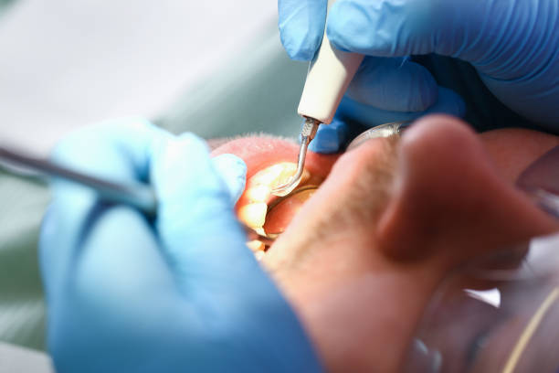 Best Tooth Infection Emergency Dentist  in Oelwein, IA
