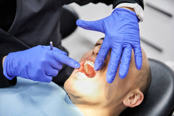 Best Emergency Gum Pain Relief  in Oelwein, IA