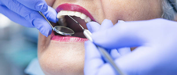 Best Knocked-Out Tooth Emergency  in Oelwein, IA